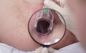 Slim chick curls up her toes as doctor probes her pussy